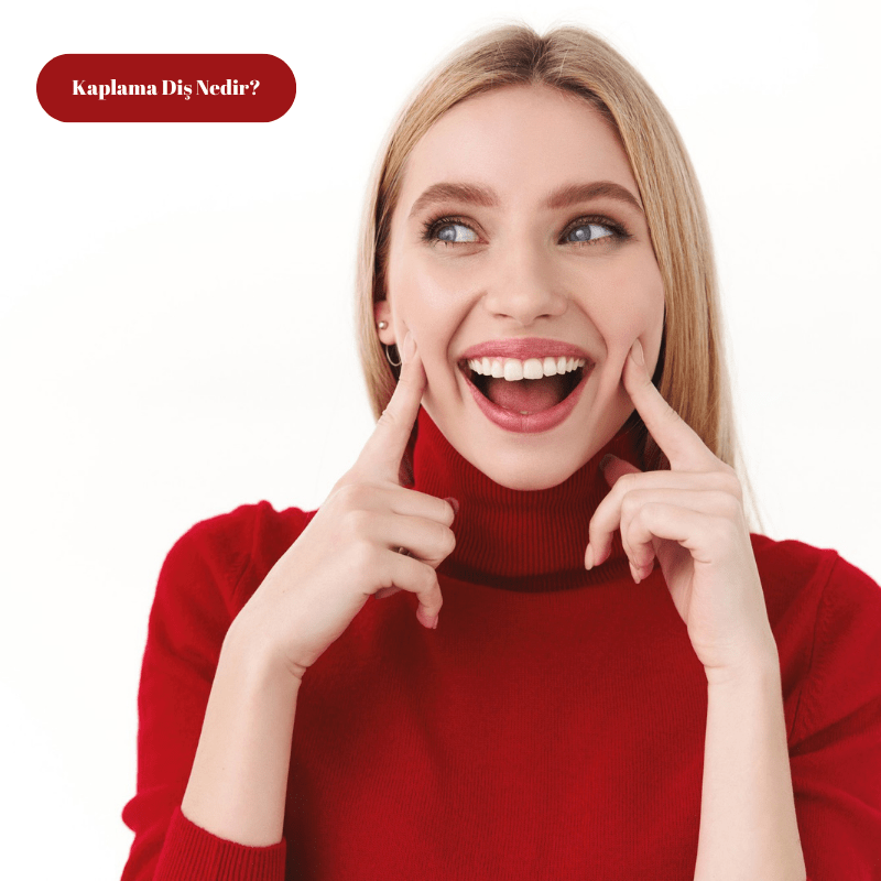 Kaplama Diş Nedir