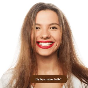 Diş Beyazlatma Nedir