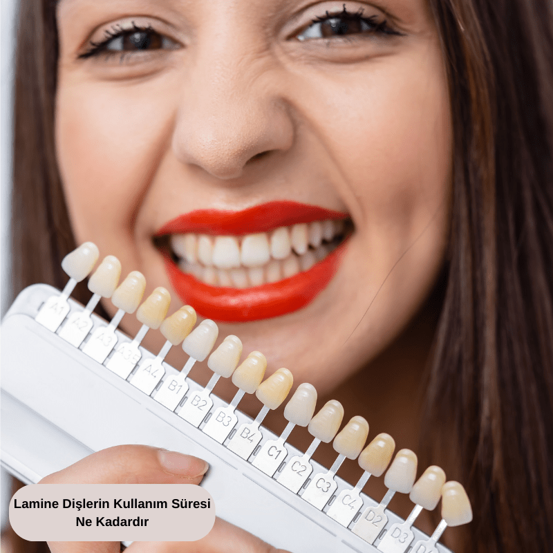Lamine Dişlerin Kullanım Süresi Ne Kadardır