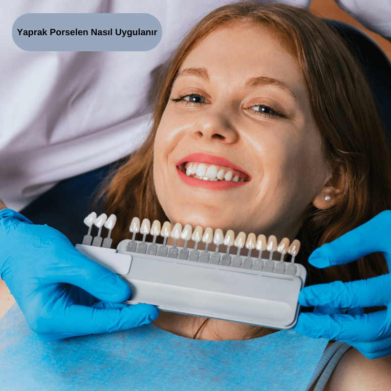 Yaprak Porselen Nasıl Uygulanır