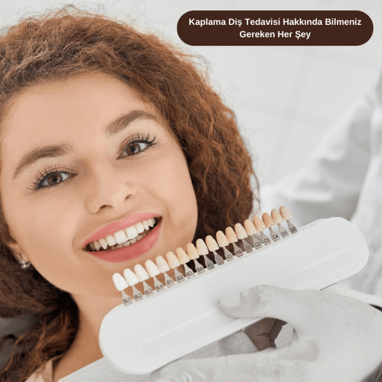 Kaplama Diş Tedavisi Hakkında Bilmeniz Gereken Her Şey