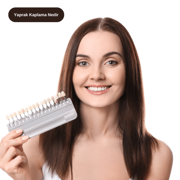 Yaprak Kaplama Nedir